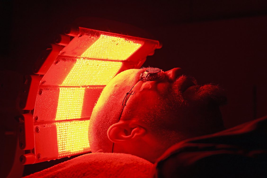 Photodynamic Therapy Red Light